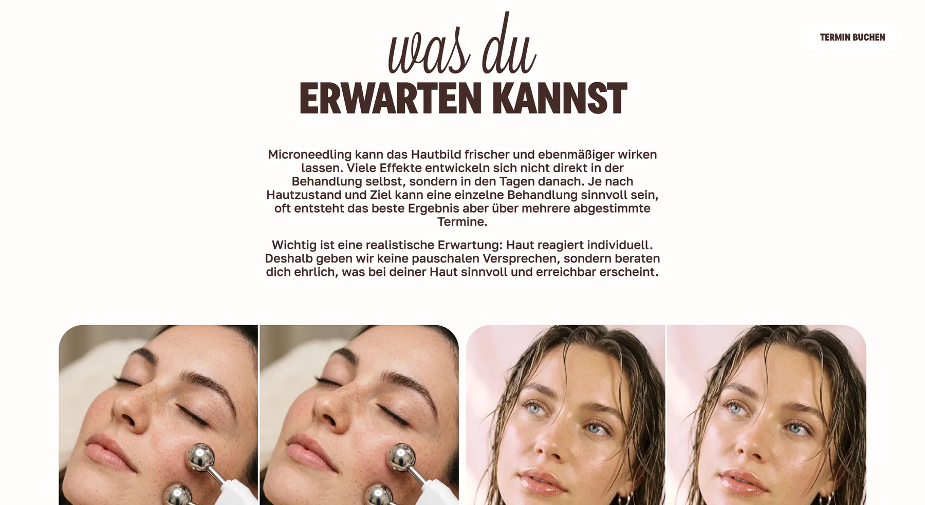 Фотографический редакционный блок страницы Microneedling